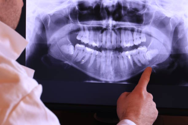 Best Broken or Cracked Tooth Emergency Dentist in Sixteen Mile Stand, OH