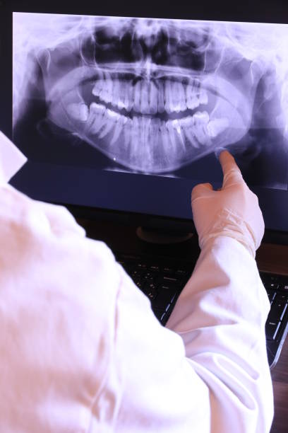Best Emergency Root Canal Treatment in Sixteen Mile Stand, OH
