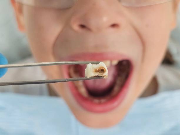 Best Emergency Dental Extractions in Sixteen Mile Stand, OH